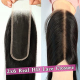 2x6 HD Skin Melt Lace Human Hair Closure
